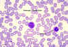 monocyte-darb.jpg (52914 bytes)