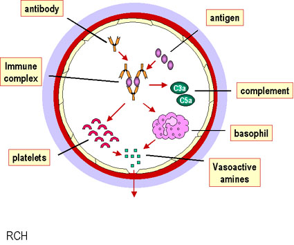 Types Of Hypersensitivity Chart