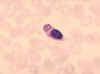 monocyte-malar.jpg (25952 bytes)