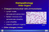 hanta-organ.gif (93918 bytes)