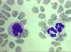 monocyte.jpg (472329 bytes)