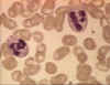 neutrophil.jpg (497512 bytes)