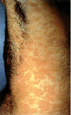 epidermo.gif (48292 bytes)