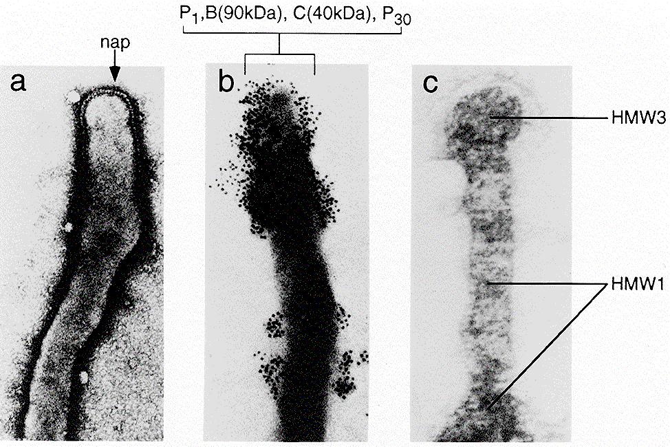 mycoplasma és uraplasm prosztatitis