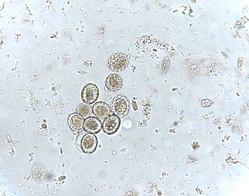 Простейшие в кале лечение. Микроскопия кала яйца гельминтов. Цисты лямблии микроскопия. Цисты лямблий микроскопия. Яйца дипилидиоз микроскопия.