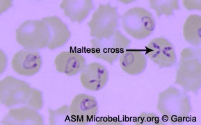 Maltese Cross Blood Smear Maltese Cross Blood Smear