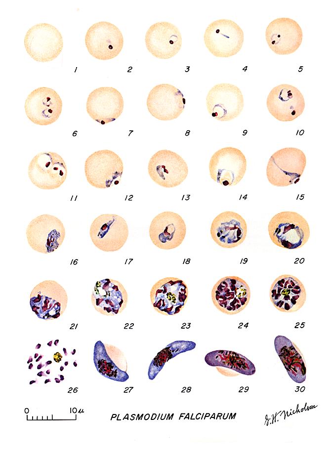 Plasmodium Vivax: Laboratory Diagnosis of Malaria | PDF | Plasmodium |  Malaria