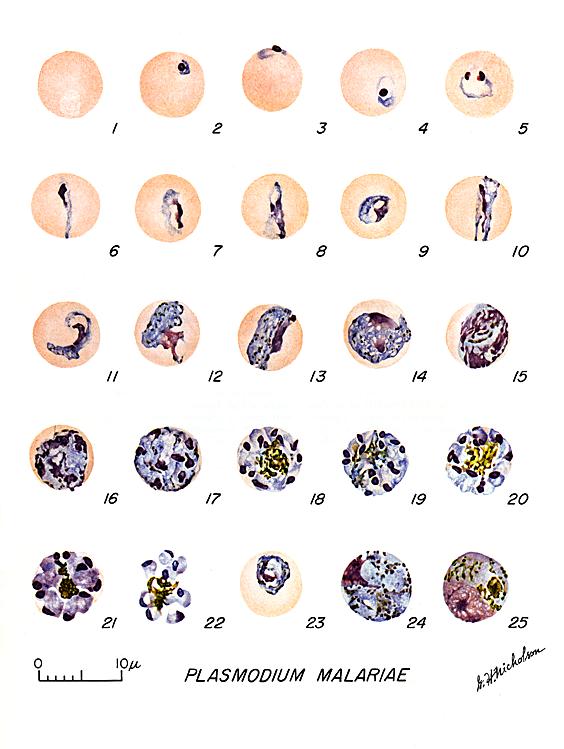 Parasite and host factors that drive heterogeneity in human malaria |  Semantic Scholar