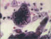 herpes-hist.jpg (495891 bytes)